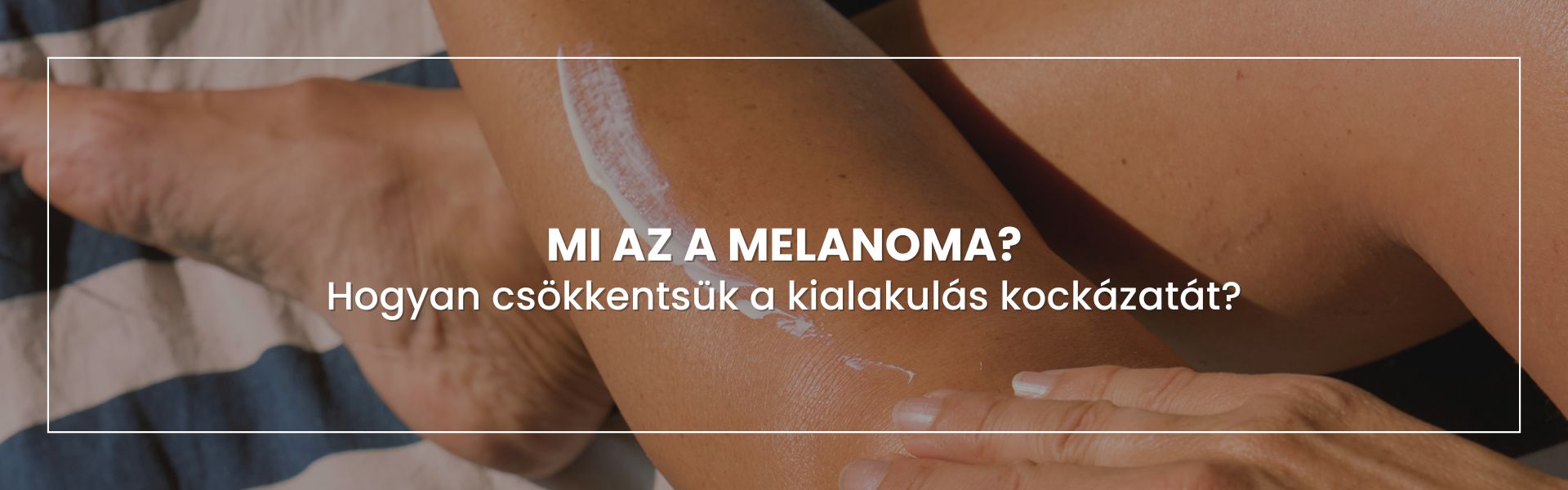 hogyan-csokkentsuk-a-melanoma-kialakulasanak-kockazatat