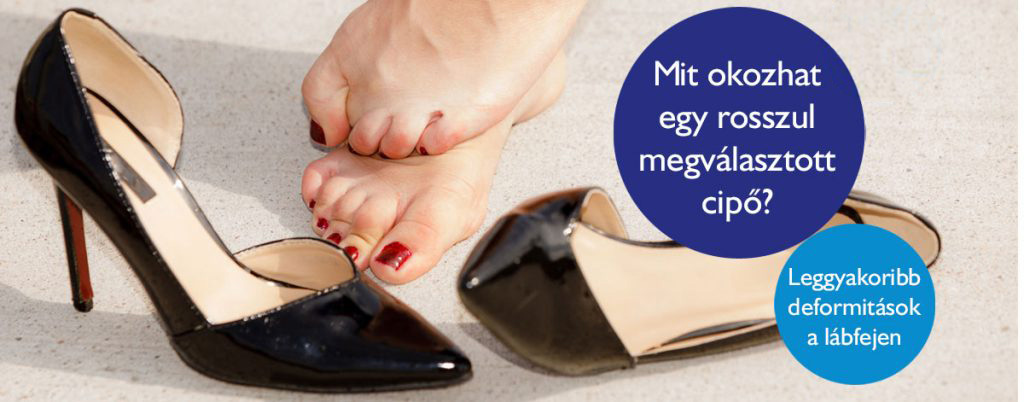 mit-okozhat-egy-rosszul-megvalasztott-cipo