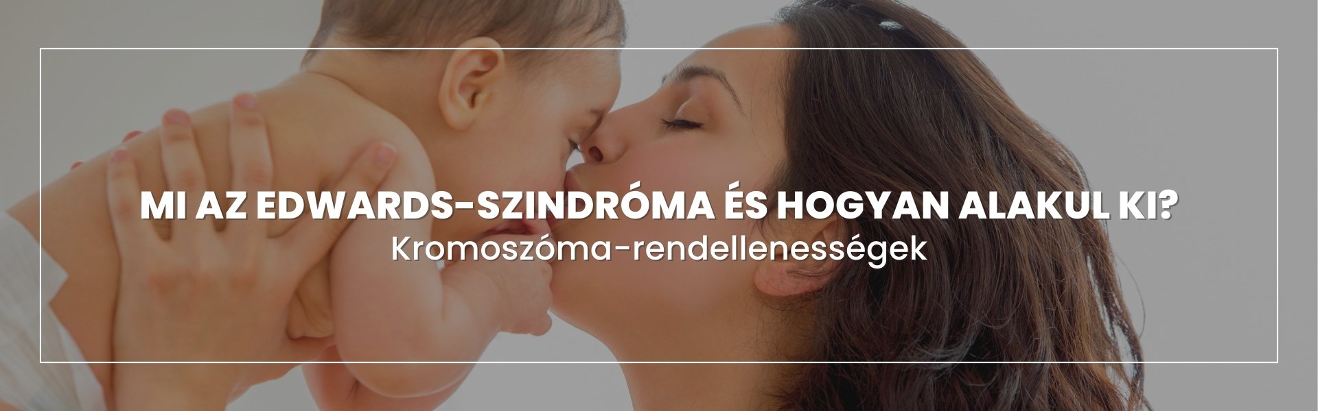 edwards-szindroma