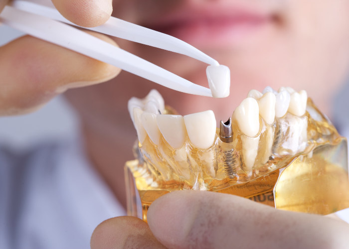 Dental tesztek Dental tesztek