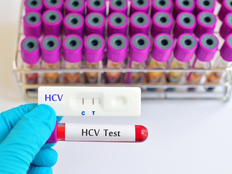 hcv teszt hcv teszt