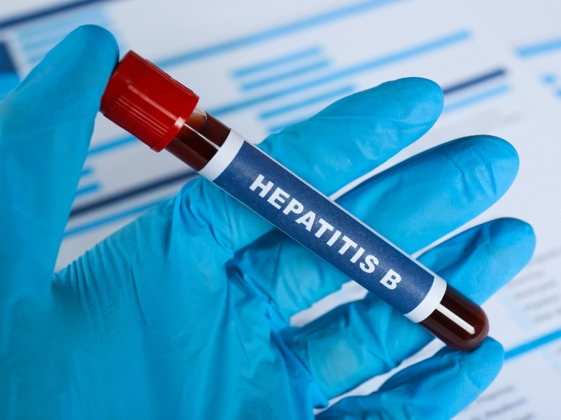 hepatitis b hepatitis b